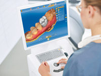 Cerec
